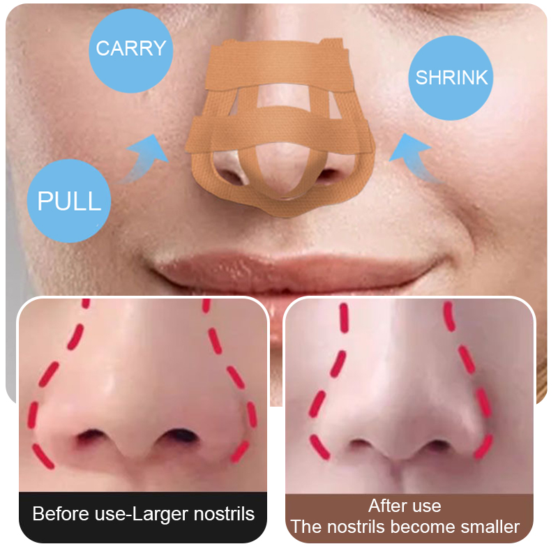 مشد جسر رفع الأنف التجميلي ، أ - مراجعة Nose Trimmer وسعره